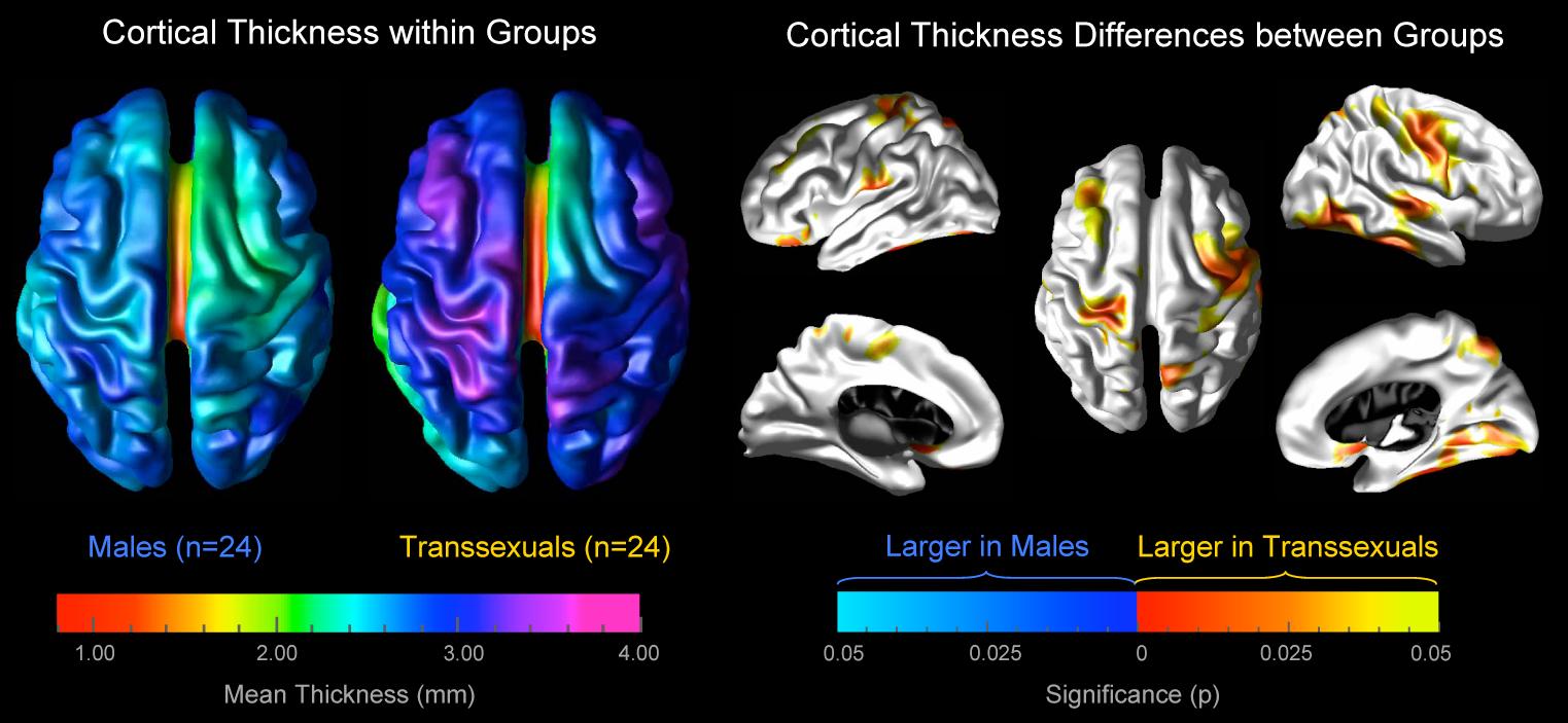 Gay Brain Vs Straight Brain 29